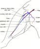 Right hind limb