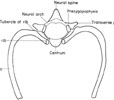 5th thoracic vertebra with rib