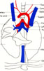 Pulmonary vessels