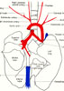 Pulmonary vessels