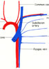 Anterior intercostal veins