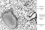 Figure 13-41