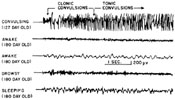 Figure 32-3