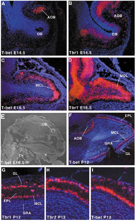 Tbx21 MGI Mouse Gene Detail - MGI:1888984 - T-box 21