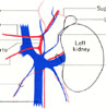 Blood supply of left kidney and suprarenal gland