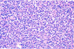 Figure 126