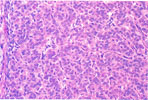 Figure 127
