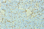 Figure 142