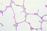 Figure 174