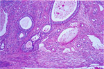 Figure 192