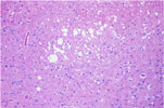 Figure 334