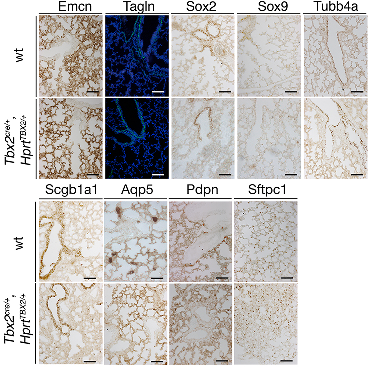 Sox2 Immunohistochemistry Gene Expression Assay - GXD