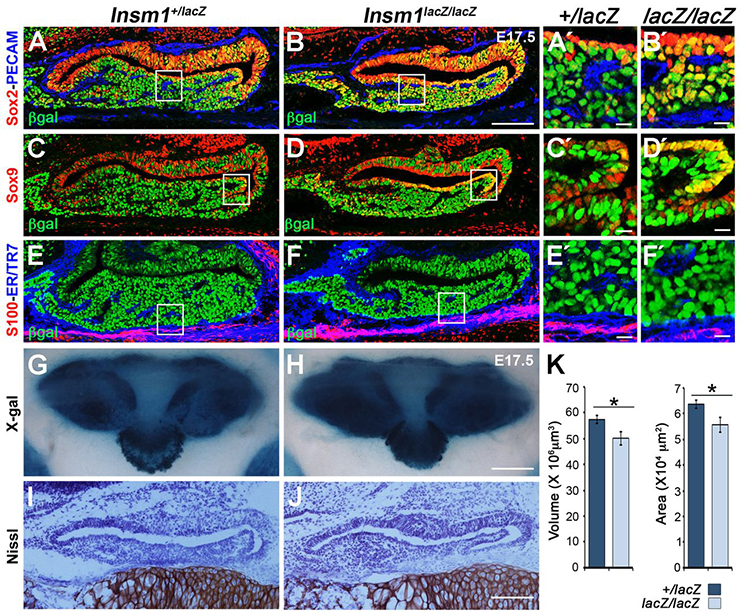 Sox2 Immunohistochemistry Gene Expression Assay - GXD