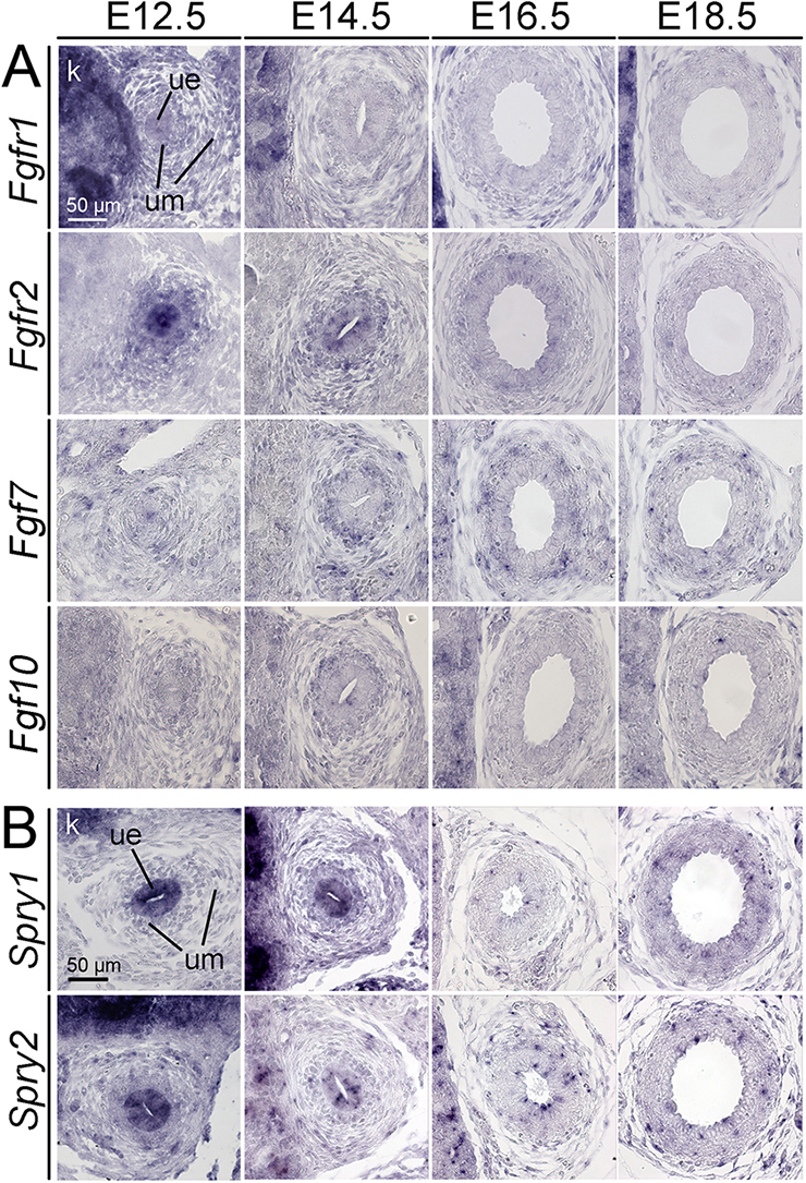 Spry1 RNA in situ Gene Expression Assay - GXD